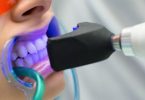 zobu balināšanas procedūra